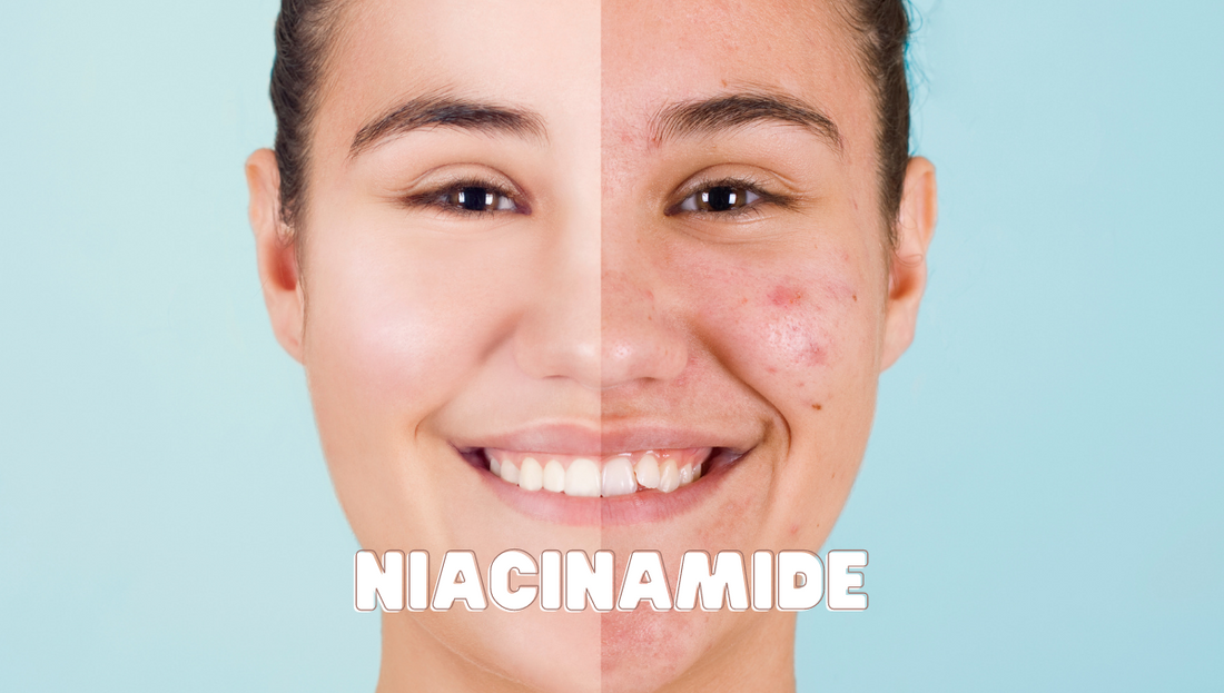 The Science of Niacinamide For Acne and How it Treats Acne | Carsha