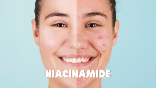 The Science of Niacinamide For Acne and How it Treats Acne | Carsha
