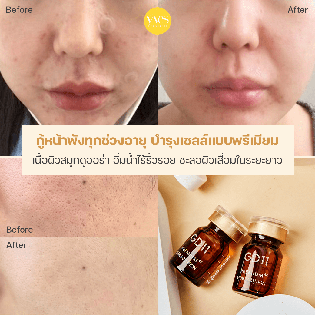 On Sale: Gd11 Premium Rx Cell Treatment Mask (6ea) | Carsha Beauty